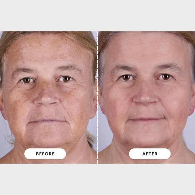 LED Light Therapy Mask Series 2